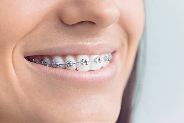 Best Veneers and Lumineers  in Rkesburg, PA